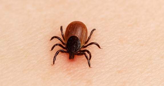 Nahaufnahme eines Zeckenbisses auf menschlicher Haut – Symbolbild für Zeckenstich-Behandlungen und korrekte GOÄ-Abrechnung bei Zeckenbiss